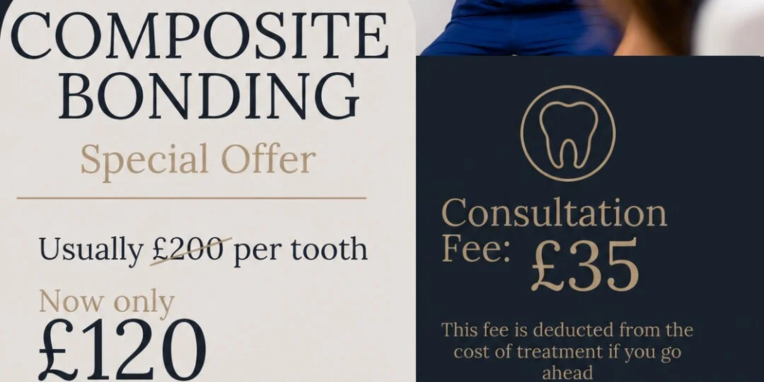 Composite Bonding Special Offer — £120 Per Tooth