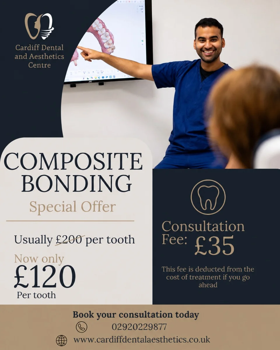 composite bonding special offer — cardiff dental and aesthetics centre Composite bonding special offer — £120 per tooth at Cardiff Dental and Aesthetics Centre