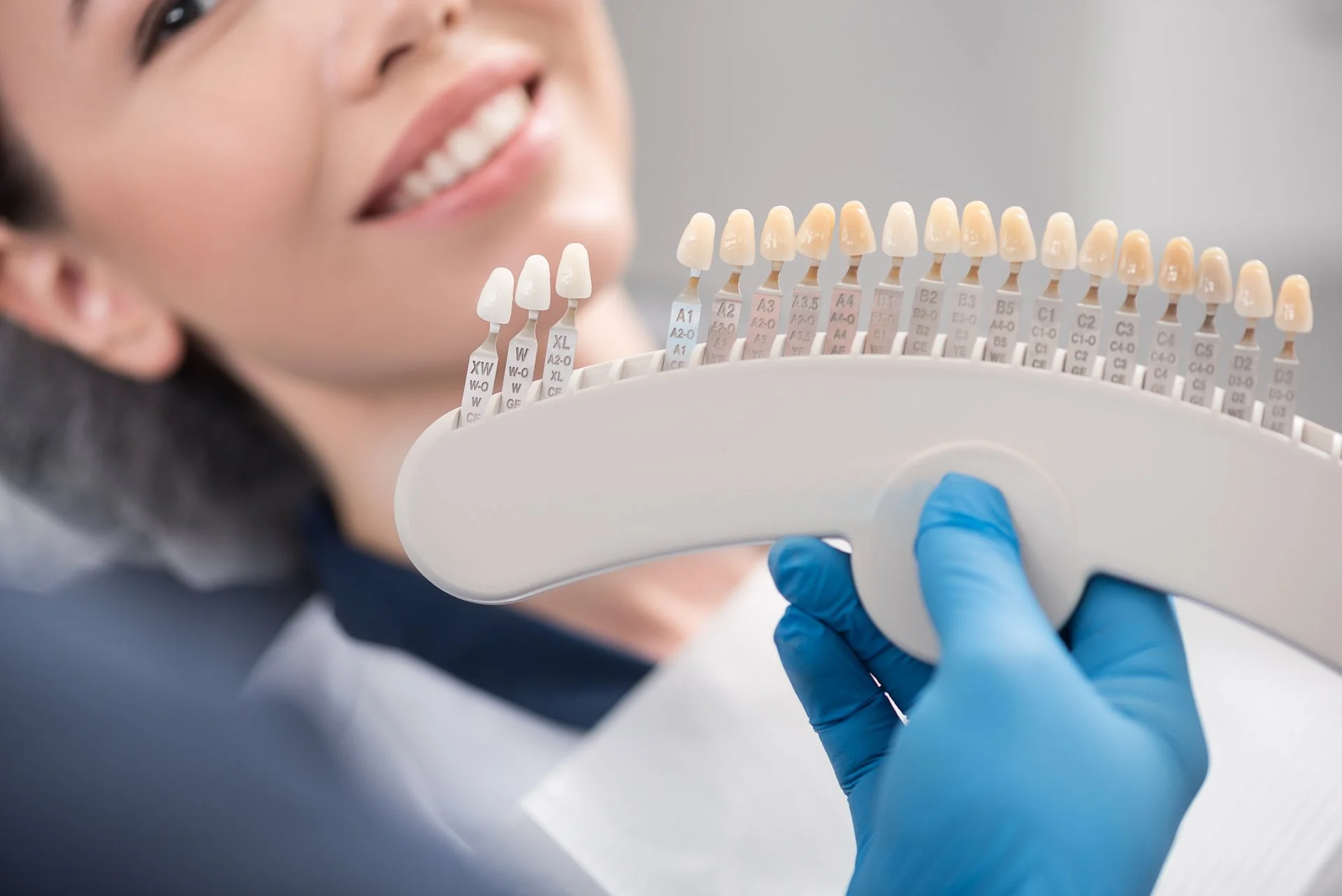 Veneers